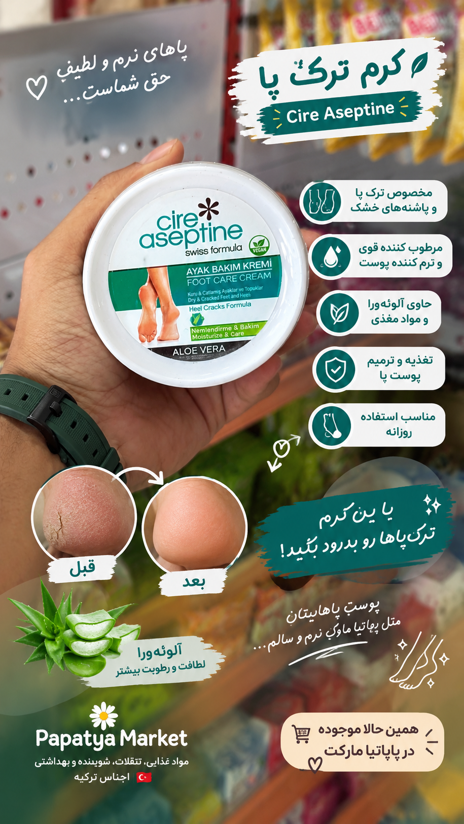 کرم ضد ترک پا